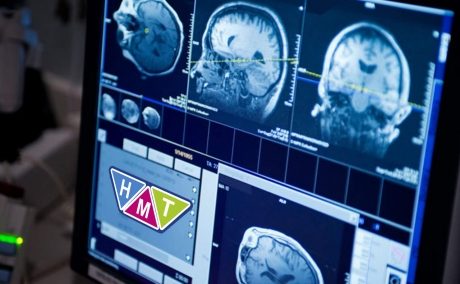 МРТ: расширенные исследования головного мозга